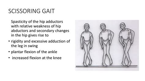 Scissors Gait Definition