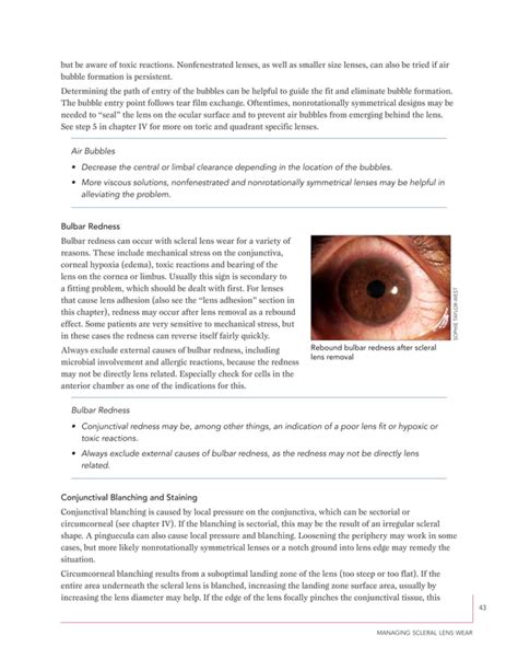 scleral lens fitting cpt code