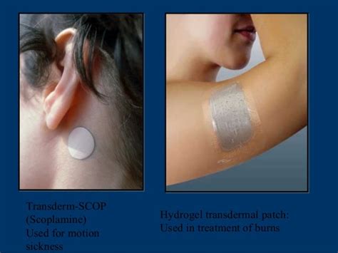 scopolamine patch alternative placement