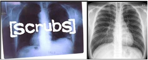 Scrubs Xray Backwards