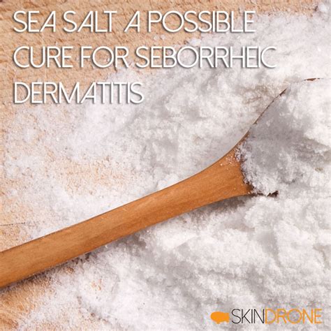 sea salt seborrheic dermatitis reddit