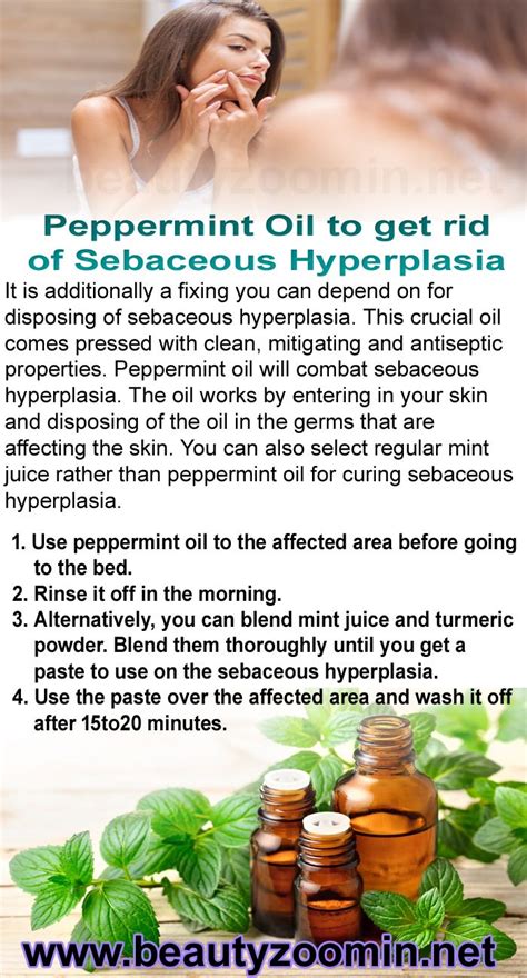 sebaceous hyperplasia home remedy