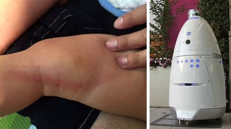 Security Robot Injures Child