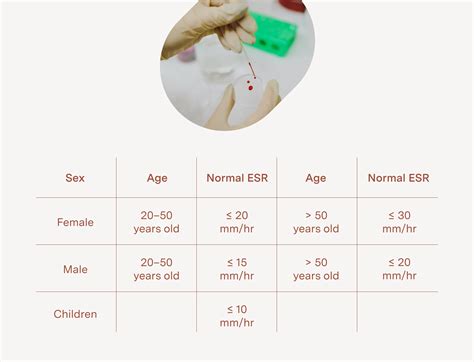 Understanding Your Sed Rate Lab Results: What Do They Mean?