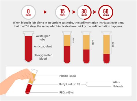 Understanding Your Sedimentation Rate ESR: What High or Low Results Mean for Your Health