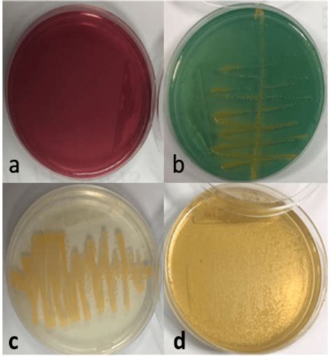 selective agar for staphylococcus aureus
