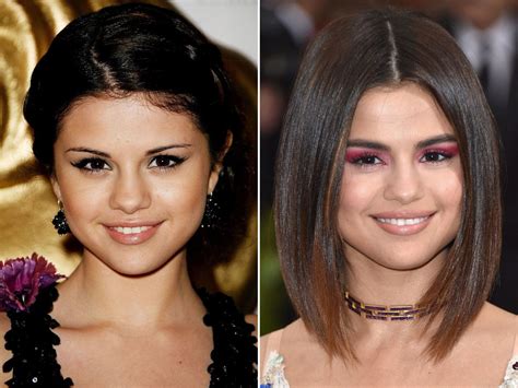 selena gomez before and after surgery