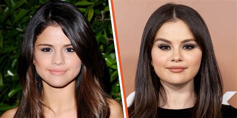 selena gomez plastic surgery 2023