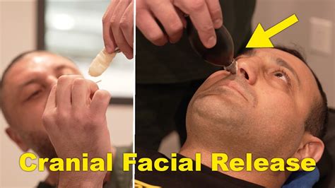 Self Cranial Release Technique