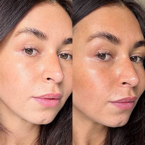 Self Tan Before Botox