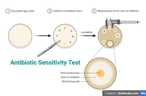 Sensitivity Testing In Microbiology Is Performed To