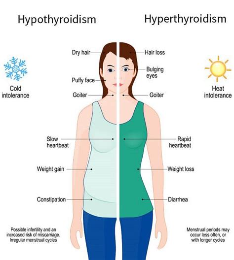 sensitivity to cold thyroid