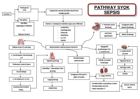 sepsis adalah infeksi pada