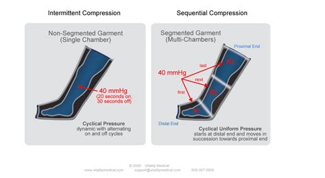 Sequential Vs Intermittent Compression