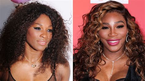 serena williams plastic surgery