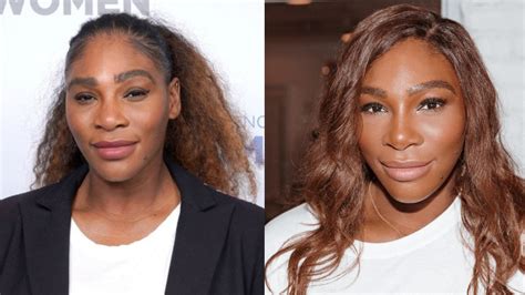 serena williams surgery