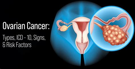 serous ovarian cancer icd 10