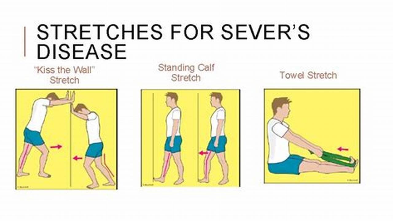 Sever's Disease Stretching Exercises