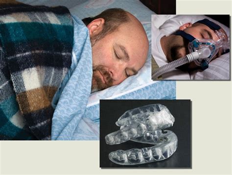 severe sleep apnea treatment options