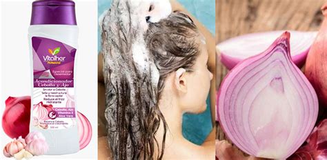 Shampoo De Cebolla Como Usar
