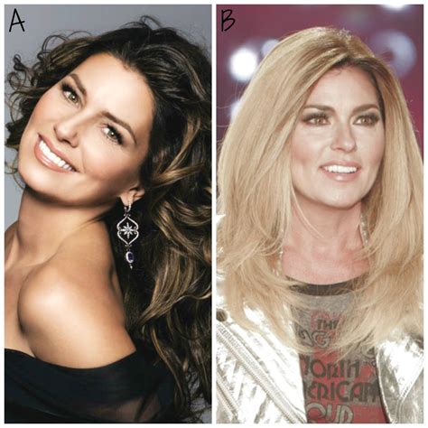 shania twain face then and now
