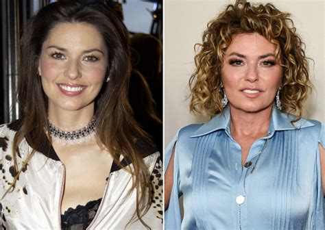 shania twain pictures before plastic surgery