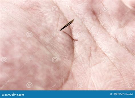 Sharp Pain In Finger Like Splinter