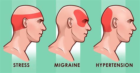 sharp pain in right side of head and dizziness