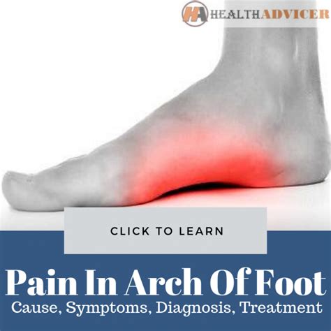 sharp pain in side of foot near arch