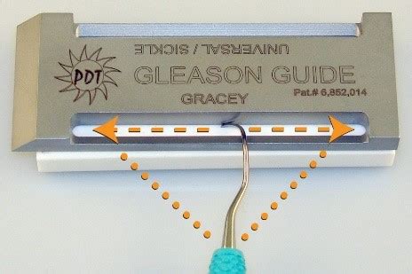 Sharpening With Gleason Guide