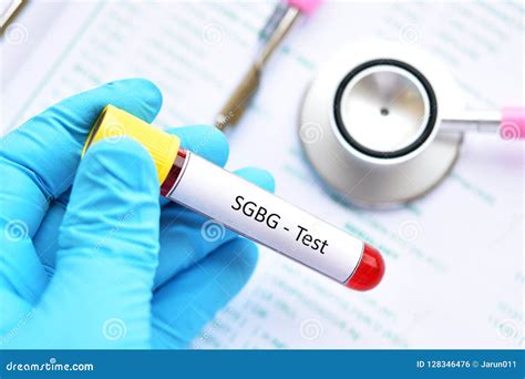 shbg blood test tube color