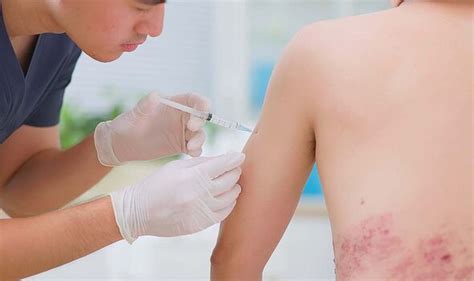 What Age Should You Get the Shingles Jab: A Guide to Protection