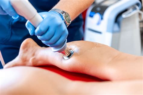 Shockwave Therapy Session