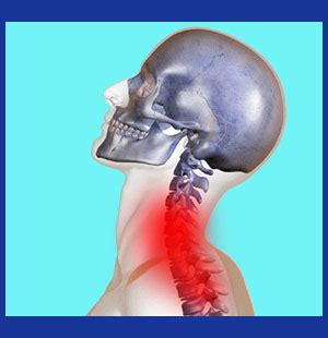 shooting pain side of neck