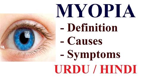 Short Sightedness Meaning In Urdu