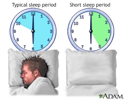 short sleeper syndrome test