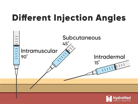 Shot Injection Sites