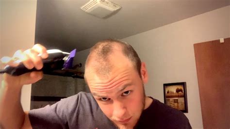 Should I Shave Or Buzz My Balding Head 