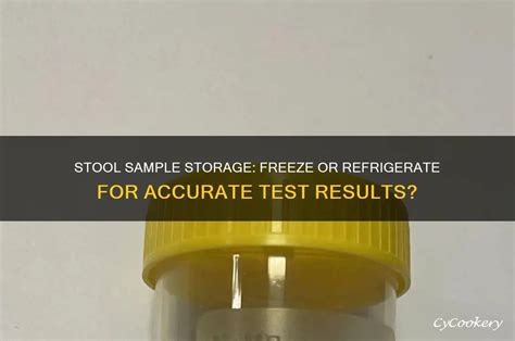 Should Stool Samples Be Refrigerated