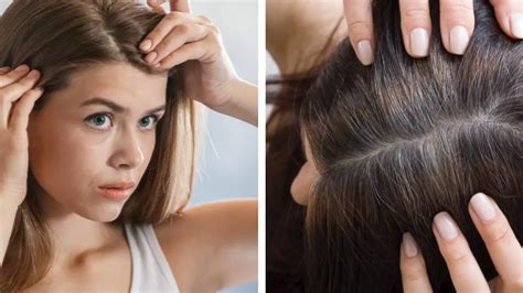 Should You Pull Grey Hairs