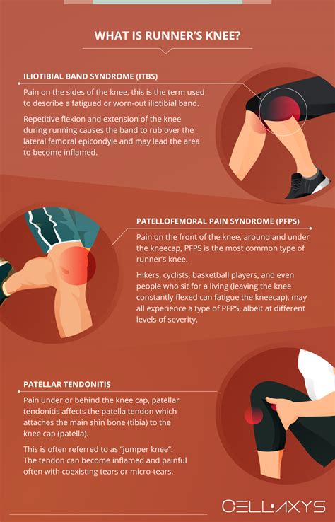 Should You Run With Knee Problems