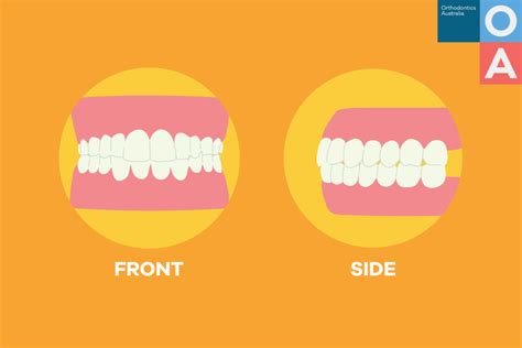 should your teeth be touching
