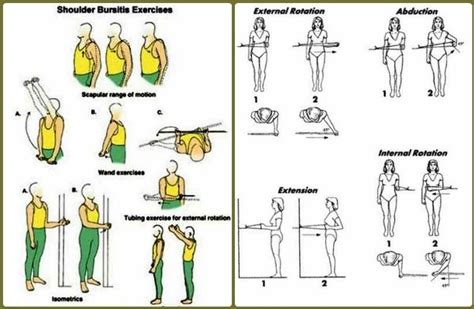 Relieve Shoulder Bursitis with These Effective Exercises