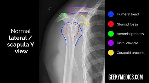 Shoulder X Ray Normal Anatomy