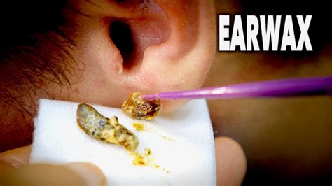 Shower Head Ear Wax