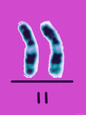 sickle cell chromosome 11
