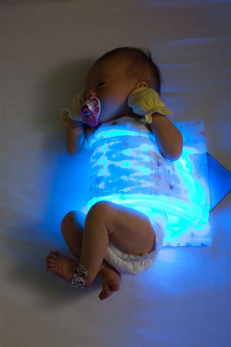 Side Effects Of Biliblanket