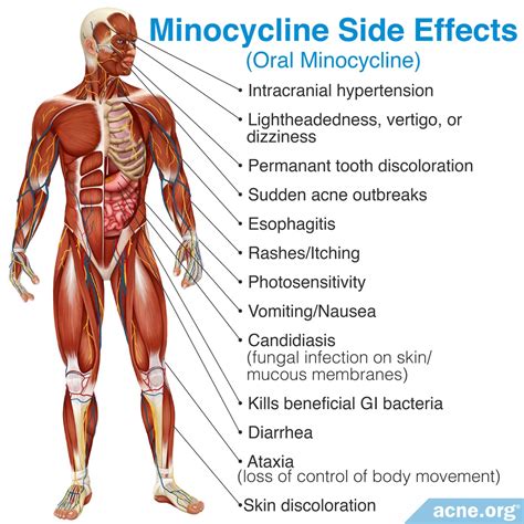 Minocycline Side Effects: What You Need to Know