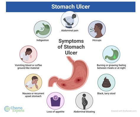 10 Signs and Symptoms of a Stomach Ulcer You Should Not Ignore Top 10