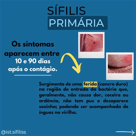 sifilis genital primaria